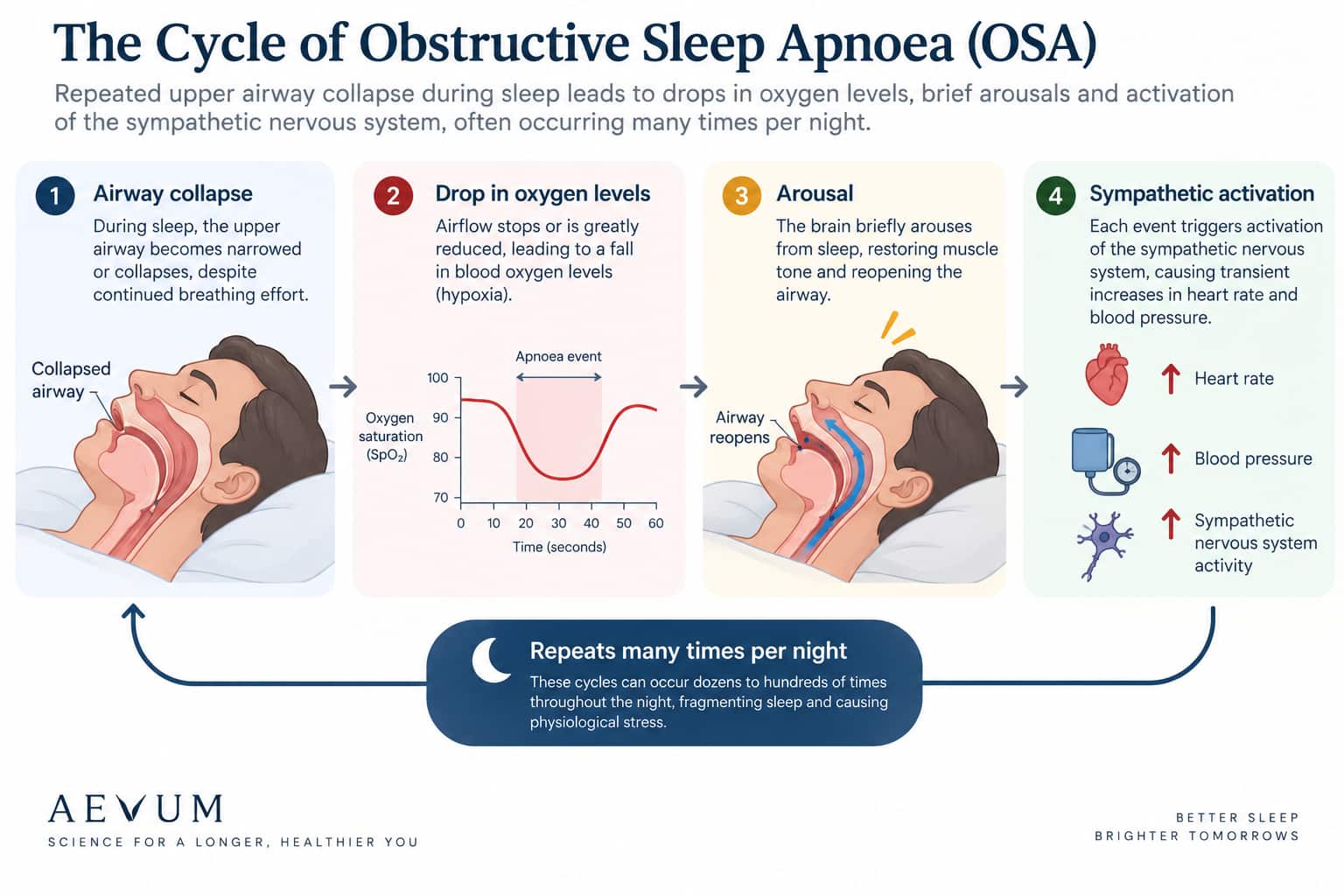 A diagram showing the OSA mechanism — airway collapse leading to oxygen drop, arousal, and repeated sympathetic nervous system activation across the night