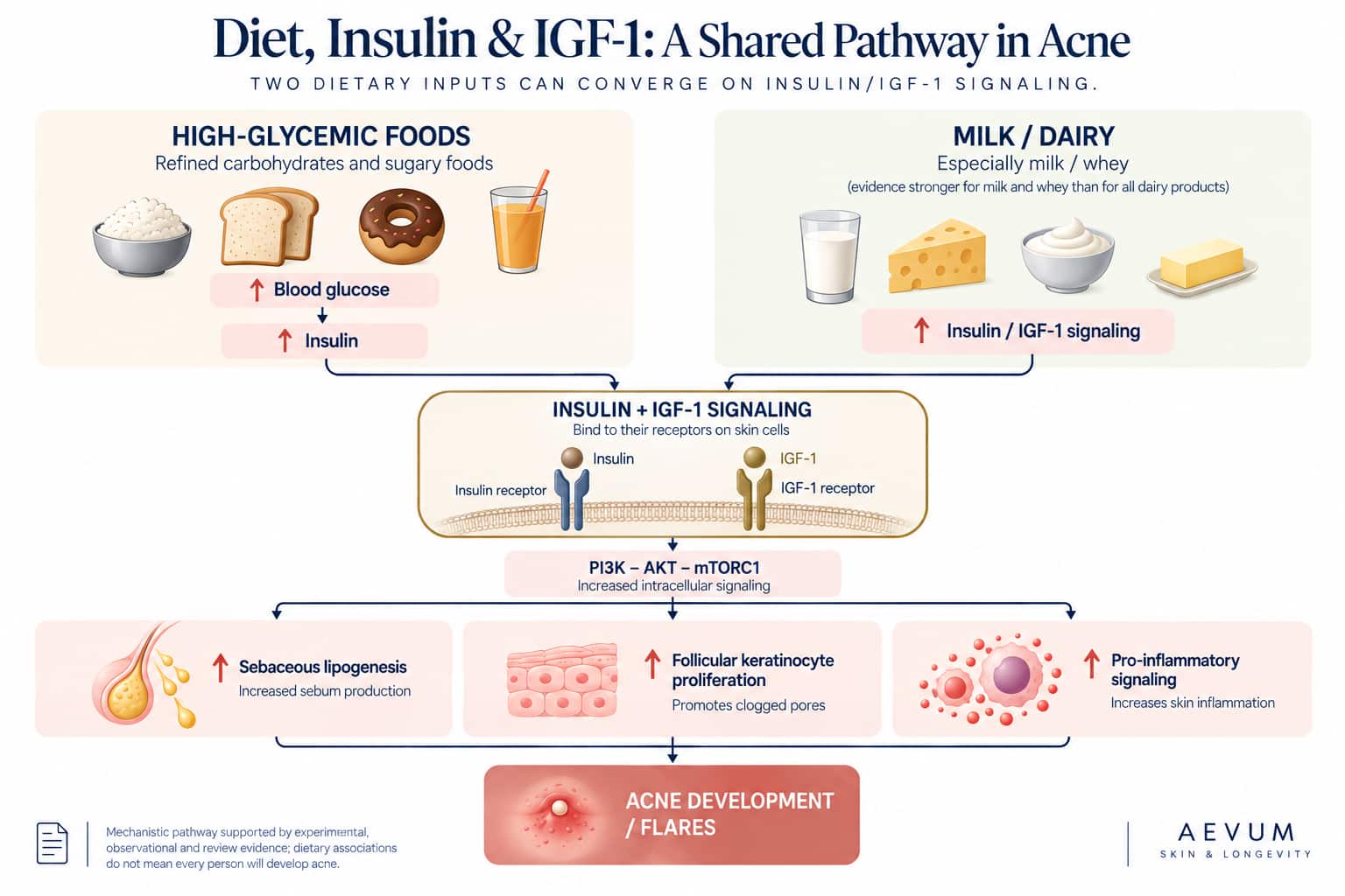 A diagram showing the shared insulin/IGF-1 pathway connecting both high-glycemic-index diets and dairy intake to acne development