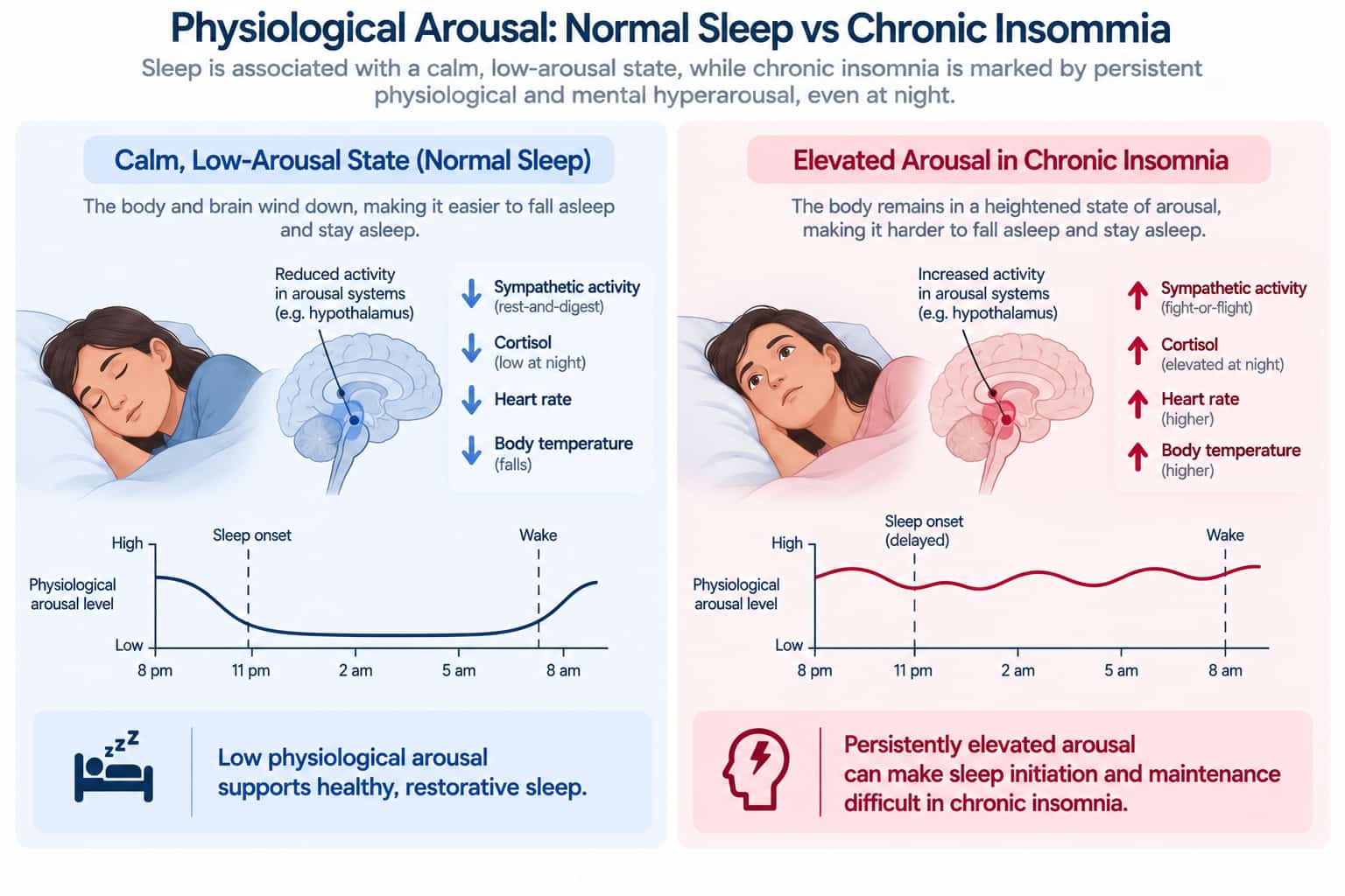 A diagram contrasting a calm, low-arousal state conducive to sleep with the elevated physiological arousal pattern seen in chronic insomnia