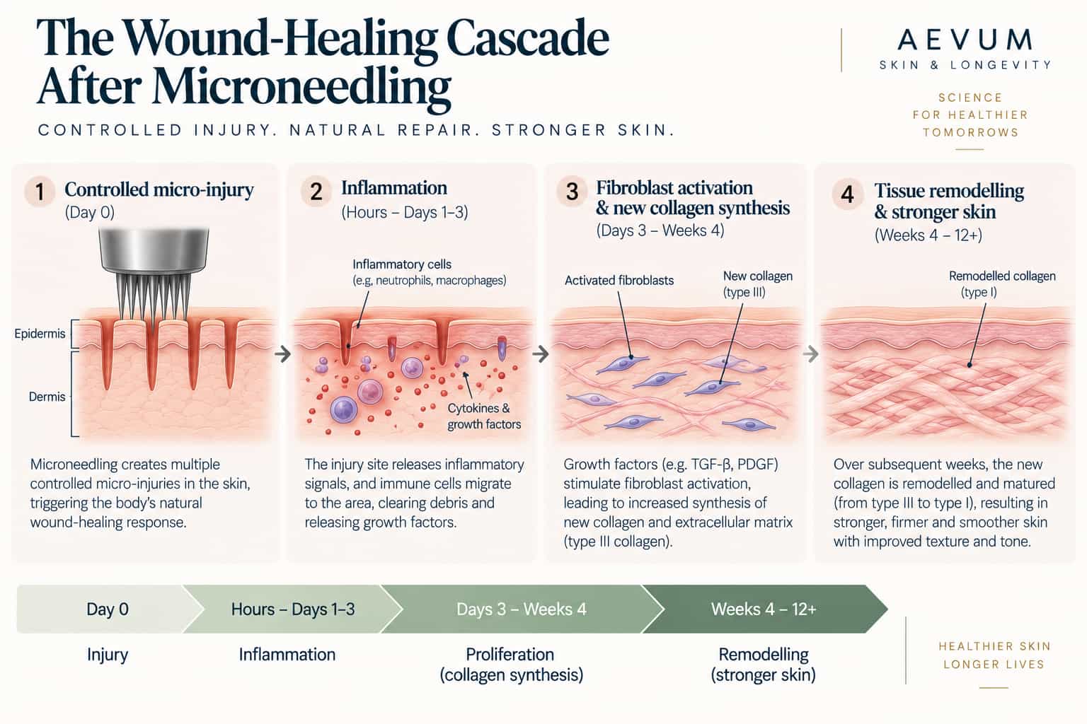 A diagram showing the wound-healing cascade triggered by microneedling — inflammation, fibroblast activation and new collagen synthesis, and tissue remodelling over subsequent weeks