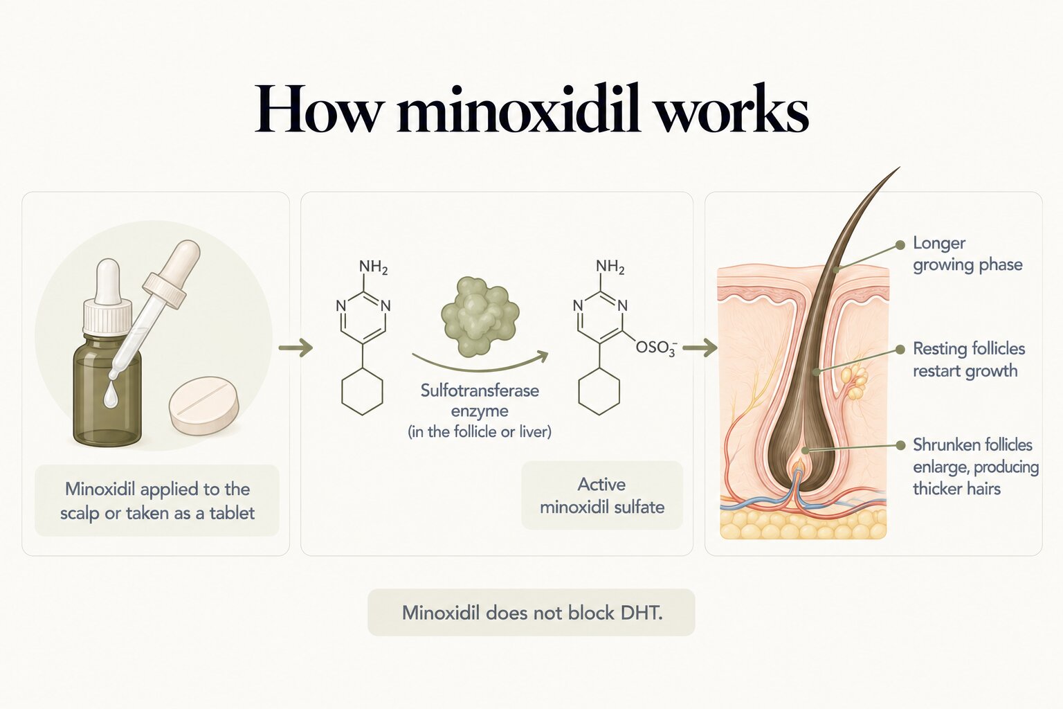 How minoxidil works: minoxidil applied to the scalp or taken as a tablet is converted by the sulfotransferase enzyme in the follicle or liver into active minoxidil sulfate, which lengthens the growing phase, restarts growth in resting follicles and enlarges shrunken follicles to produce thicker hairs. Minoxidil does not block DHT